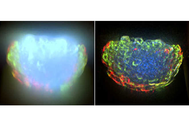 3D volume data before and after deconvolution image