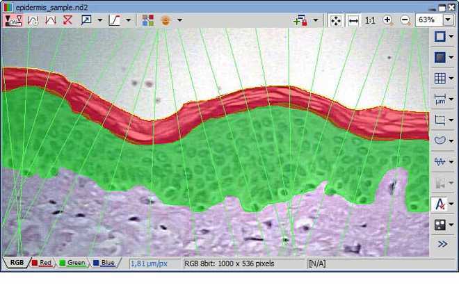 Measurement of general-shape layers image