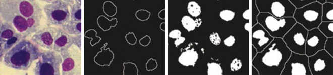 Matematická morfologie image