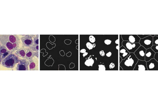 Mathematical morphology image