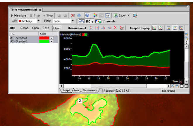 Intensity measurement on two ROIs in time image